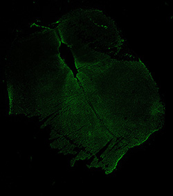 13PCW human midbrain